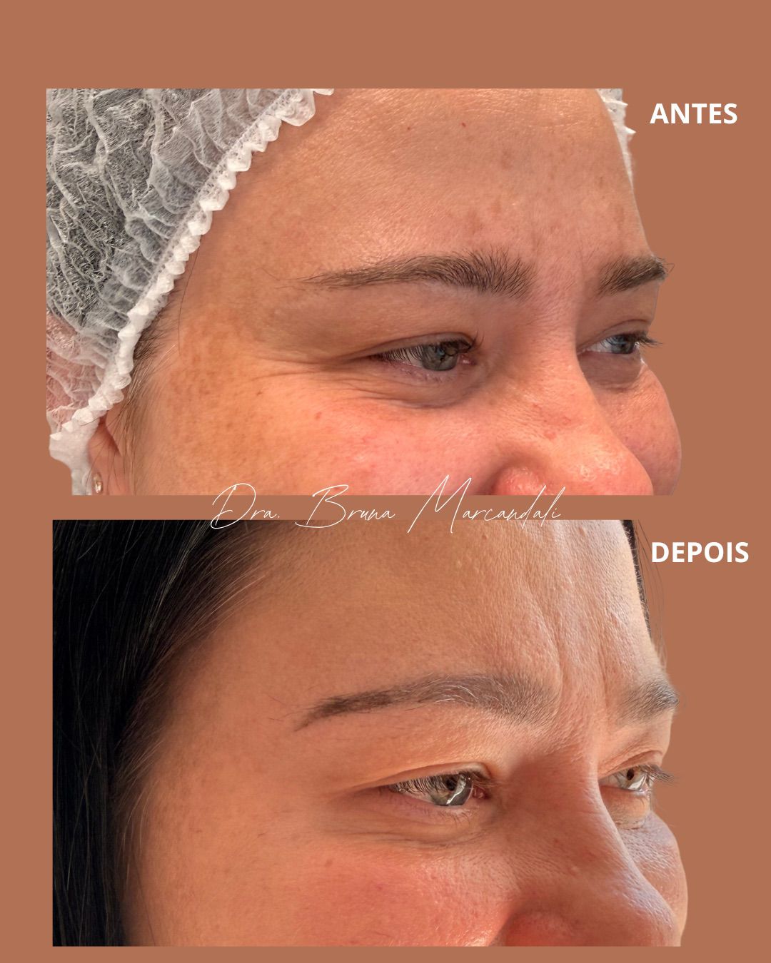 Resultado  — imagem 3
