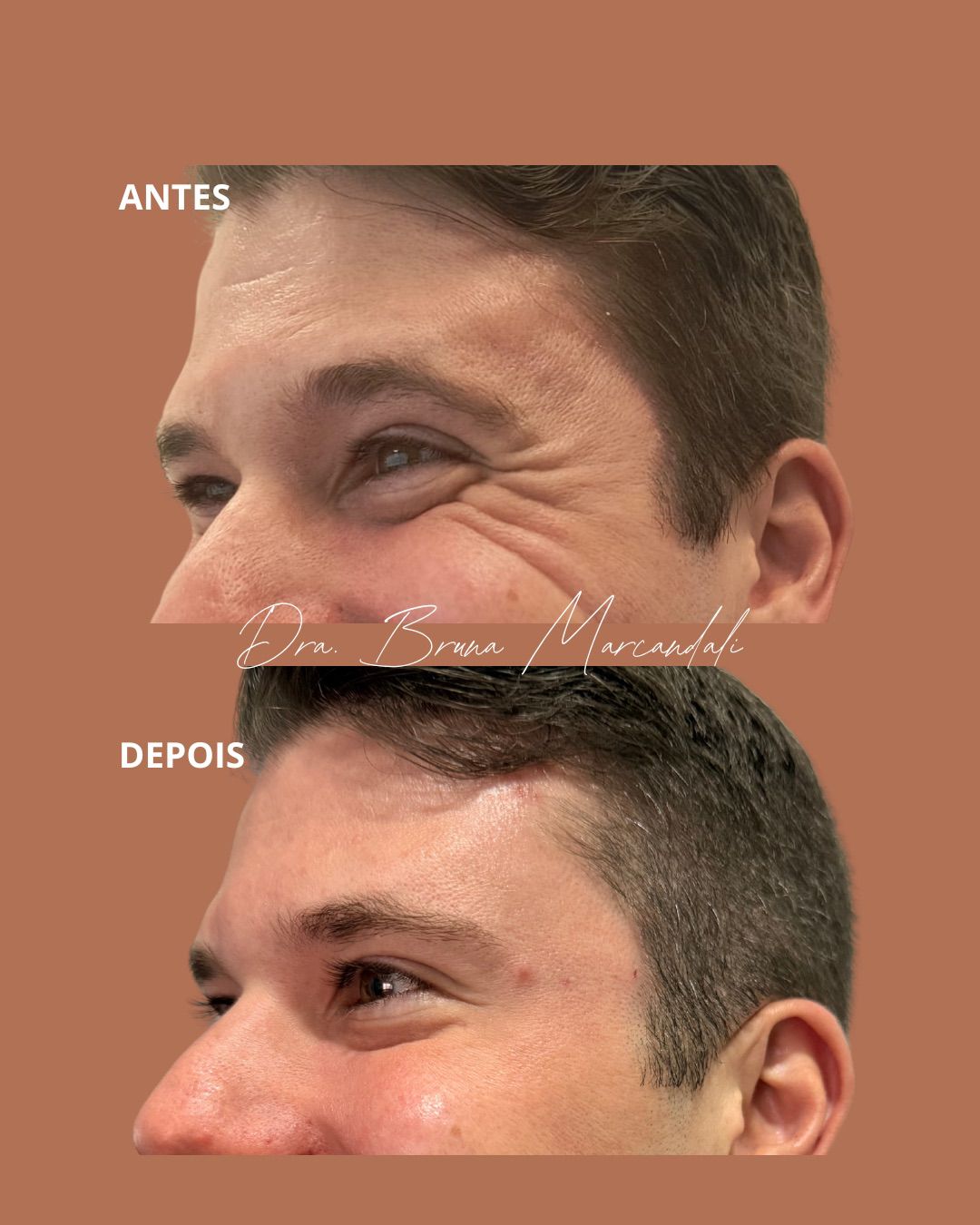 Resultado  — imagem 3